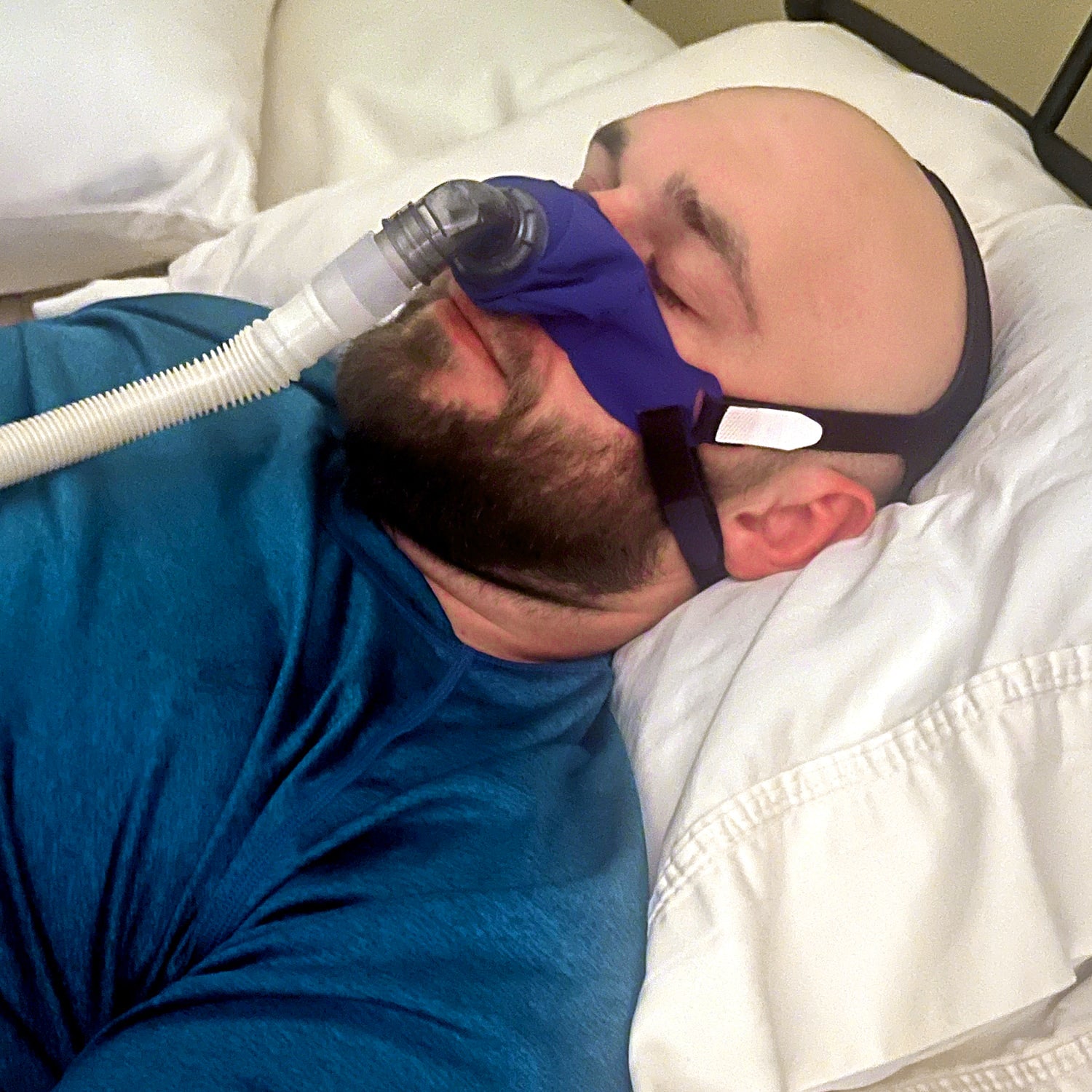 SleepWeaver 3D Soft Cloth Nasal CPAP Mask with Headgear 缩略图 3